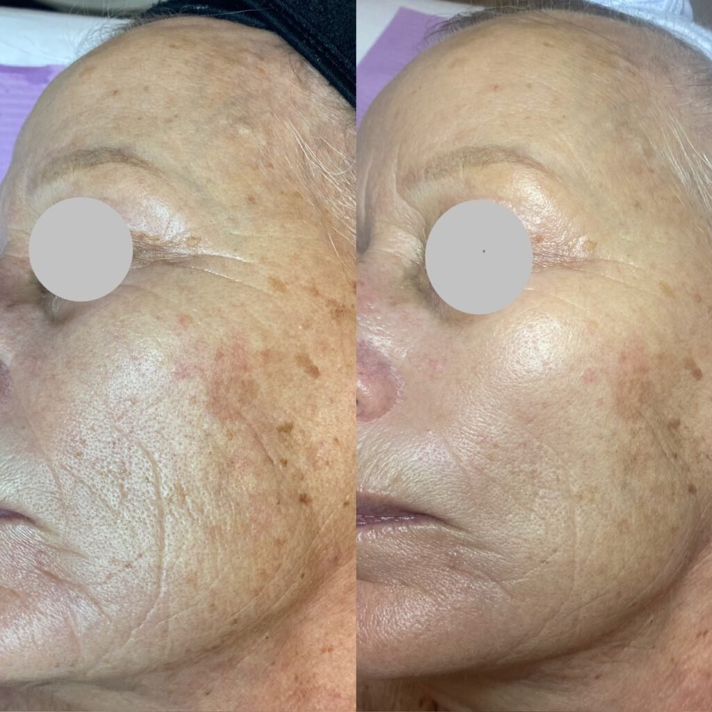 Spa Bella 1