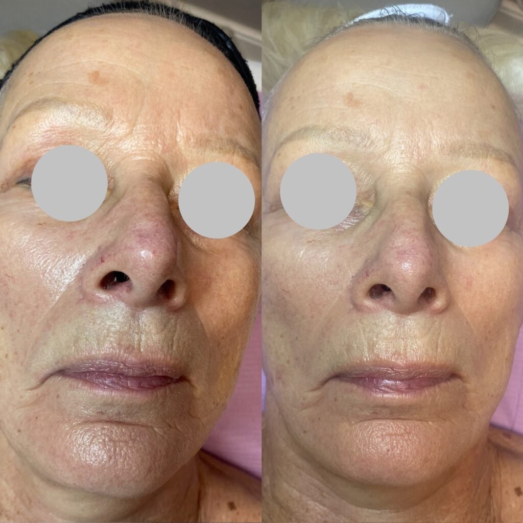 Spa Bella 3