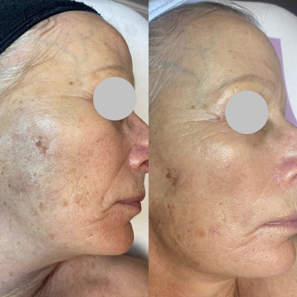 Spa Bella 2